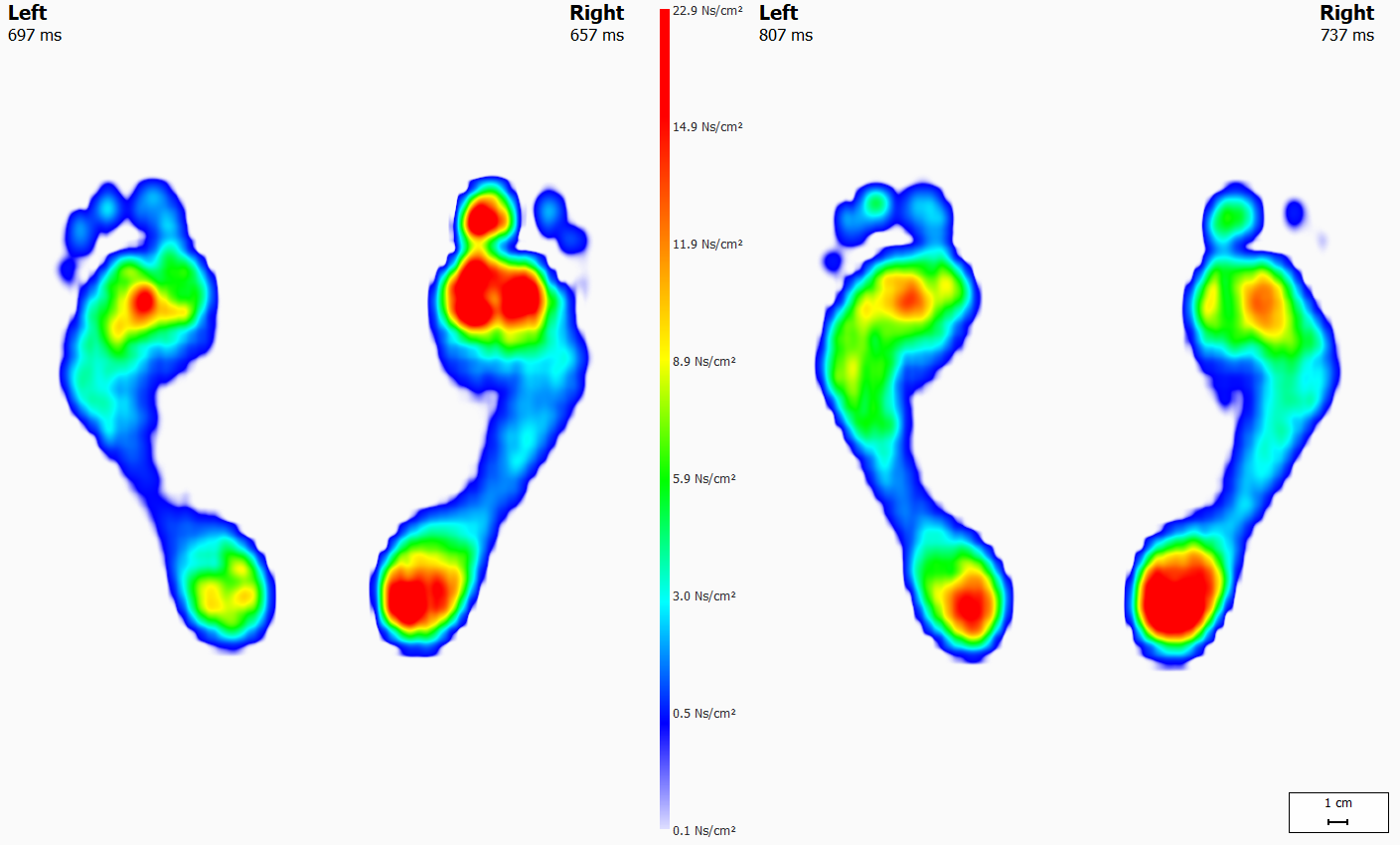 gait analysis in bristol