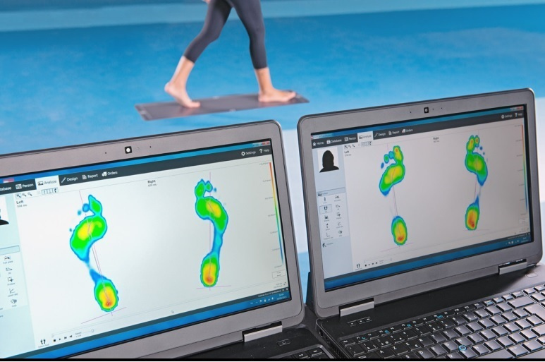 footscan gait analysis